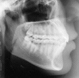 Radiologia Odontológica em Alvorada - RS